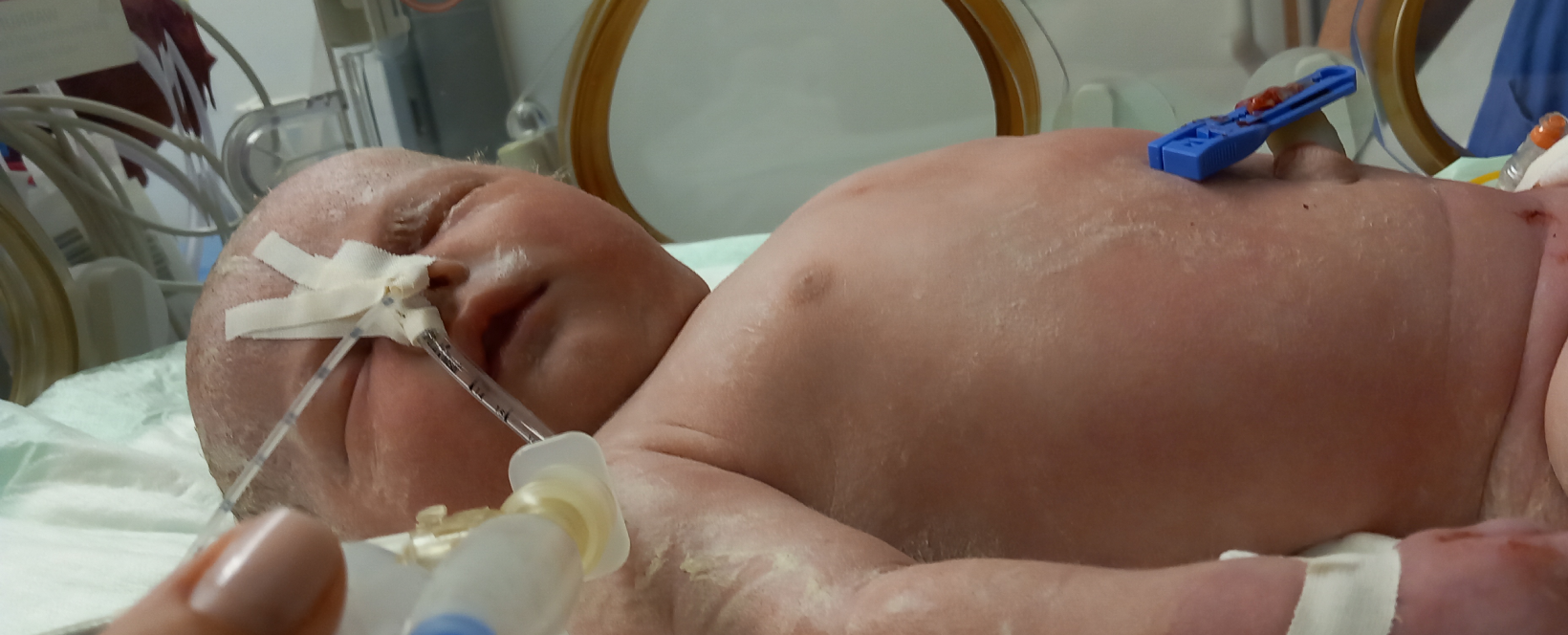 Enya nach ihrer Geburt